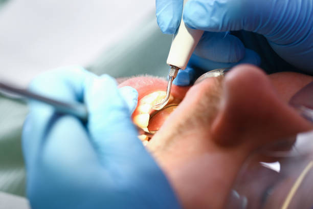 Best Urgent Care for Lost Fillings or Crowns in Konawa, OK