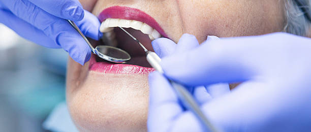 Best Emergency Tooth Extraction in Konawa, OK